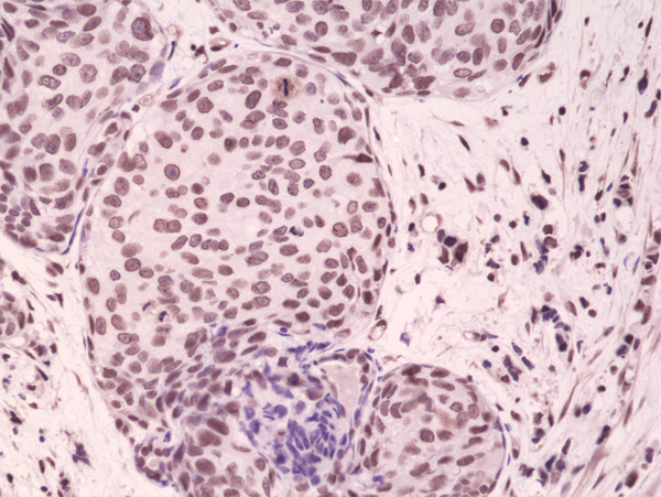 Anti-p38 MAPK Phospho (pT180/pY182) Rabbit Monoclonal Antibody, Clone RM243