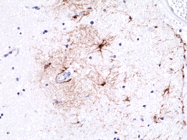 Anti-GFAP Rabbit Monoclonal Antibody, Clone RM246