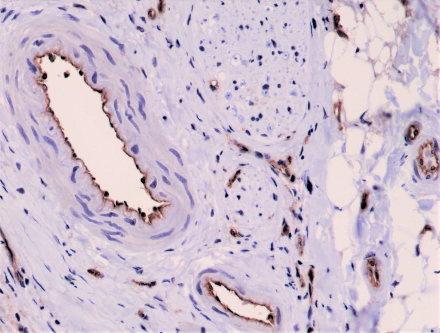Anti-CD31 (PECAM-1) Rabbit Monoclonal Antibody, Clone RM247