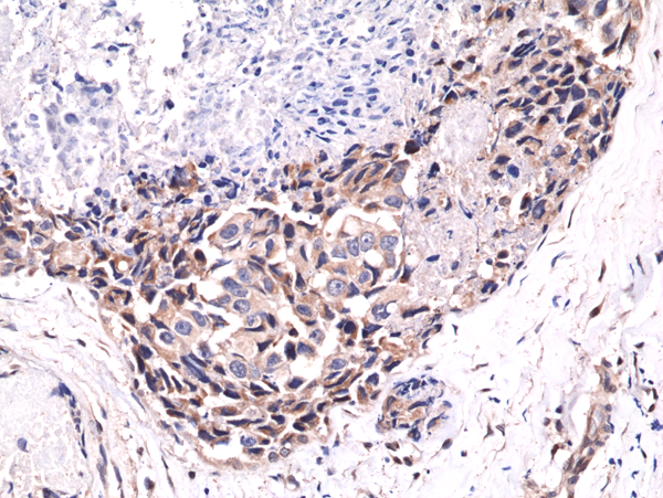 Anti-Phospho-Akt (Ser473) Rabbit Monoclonal Antibody, Clone RM251