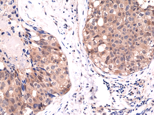 Anti-Akt1 Rabbit Monoclonal Antibody, Clone RM252