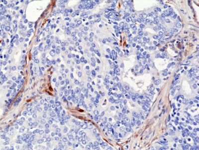 Anti-PTEN Rabbit Monoclonal Antibody Rabbit Monoclonal Antibody, Clone RM265