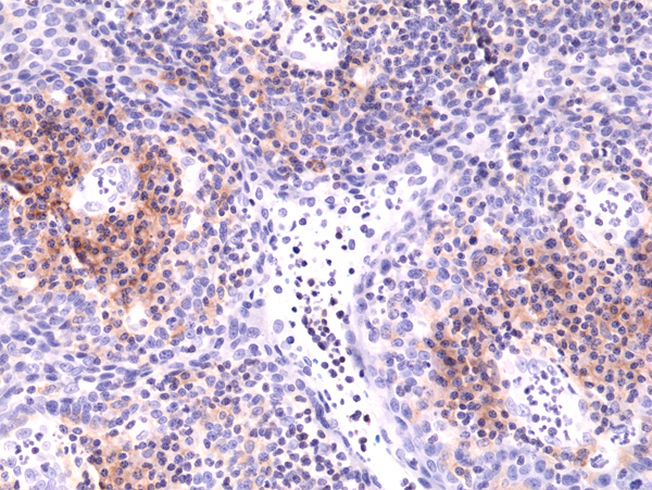 Anti-Integrin alpha 4 (ITGA4) Rabbit Monoclonal Antibody Rabbit Monoclonal Antibody, Clone RM268