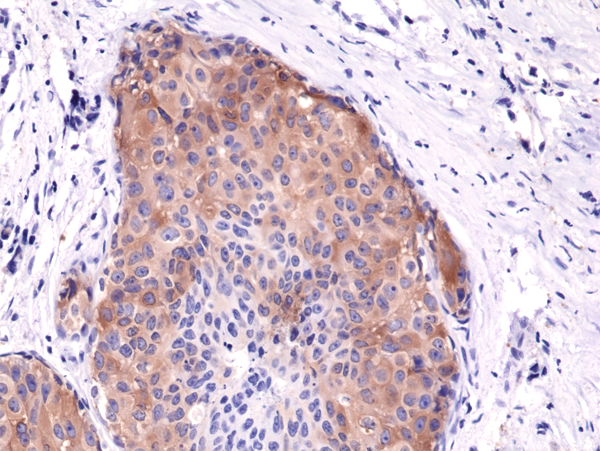 Anti-Phospho-Acetyl CoA Carboxylase (Ser79) Rabbit Monoclonal Antibody Rabbit Monoclonal Antibody, Clone RM270