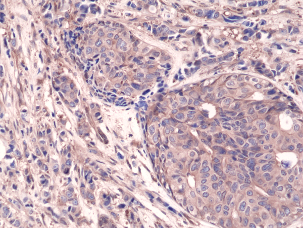 Anti-NFkB p65 Rabbit Monoclonal Antibody Rabbit Monoclonal Antibody, Clone RM273