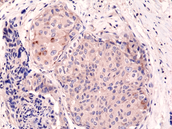 Anti-mTOR Rabbit Monoclonal Antibody Rabbit Monoclonal Antibody, Clone RM274