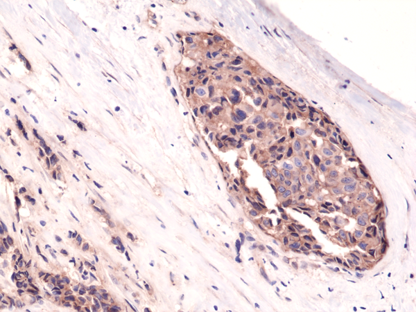 Anti-&beta;-Catenin Rabbit Monoclonal Antibody Rabbit Monoclonal Antibody, Clone RM276
