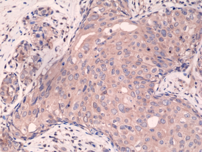 Anti-Smad4 Rabbit Monoclonal Antibody Rabbit Monoclonal Antibody, Clone RM277