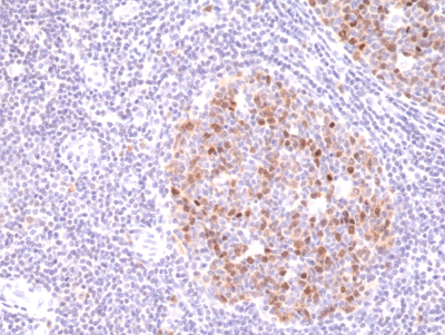 Anti-Aurora B Rabbit Monoclonal Antibody Rabbit Monoclonal Antibody, Clone RM278