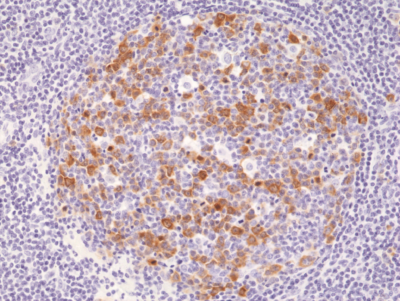 Anti-Cyclin B1 Rabbit Monoclonal Antibody Rabbit Monoclonal Antibody, Clone RM281