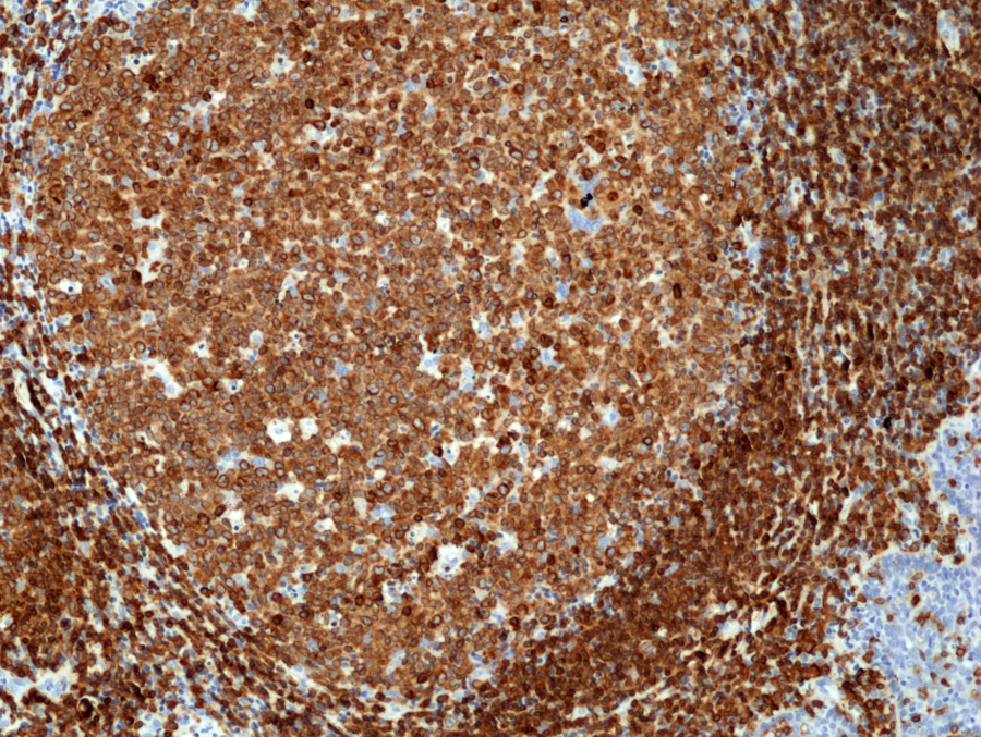 Anti-CD79a (C-term) Rabbit Monoclonal Antibody Rabbit Monoclonal Antibody, Clone RM297