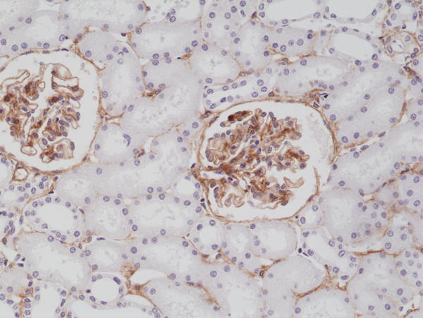 Anti-CD140b (C-term) Rabbit Monoclonal Antibody Rabbit Monoclonal Antibody, Clone RM303