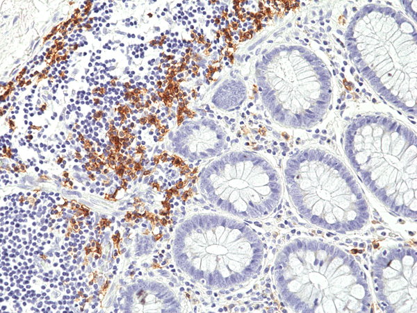 Anti-CD19 Rabbit Monoclonal Antibody, Clone RM332