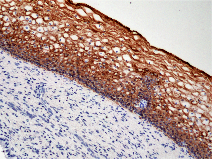 Anti-Cytokeratin 5/Cytokeratin 6 (CK-5/CK-6)  Rabbit Monoclonal Antibody, Clone RM341