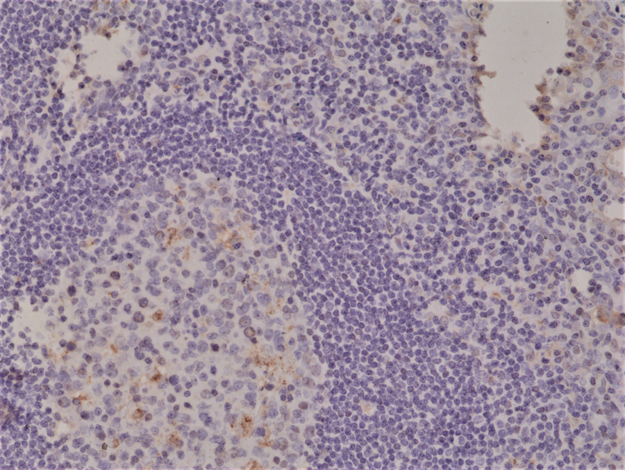 Anti-Spastin  Rabbit Monoclonal Antibody, Clone RM346