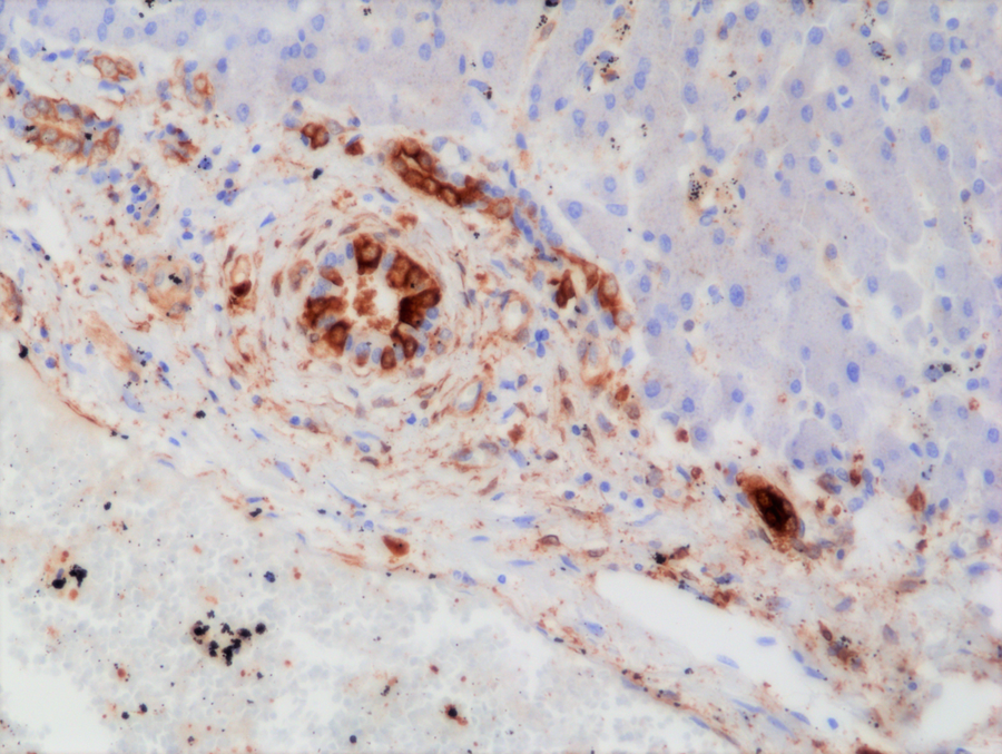 Anti-GSTP1 (GST-pi) (Glutathione S-transferase P) Rabbit Monoclonal Antibody, Clone RM347