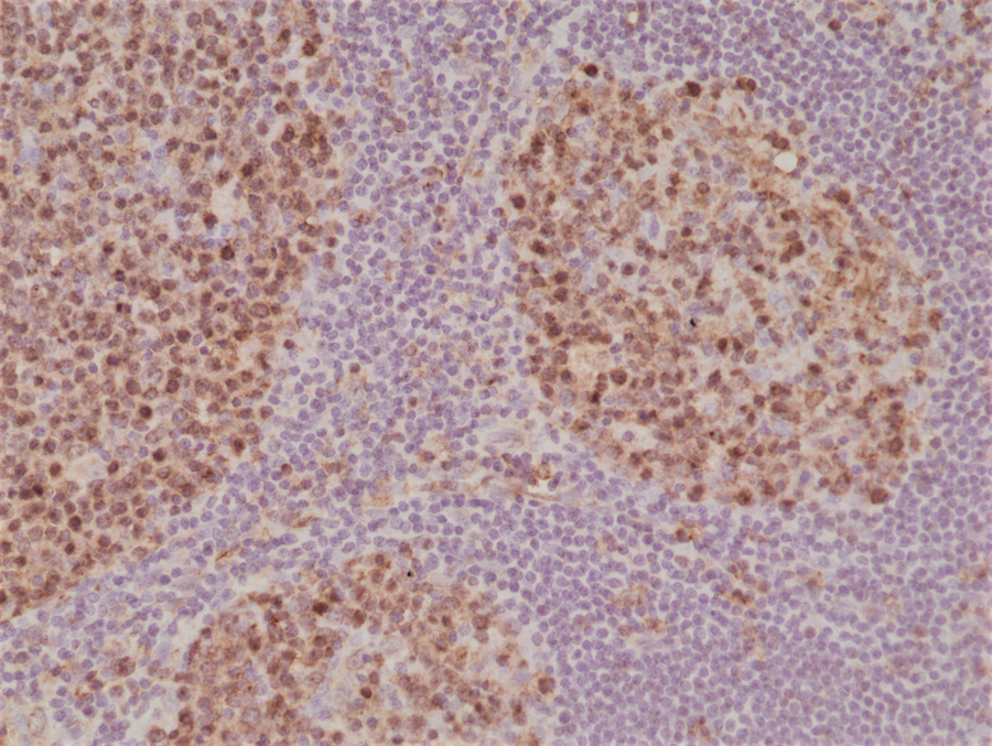 Anti-Stathmin (STMN1) Rabbit Monoclonal Antibody, Clone RM350