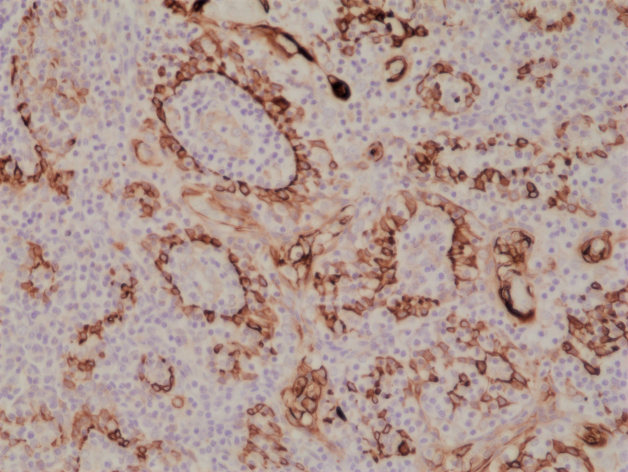 Anti-Cytokeratin 17 (CK-17) Rabbit Monoclonal Antibody, Clone RM351