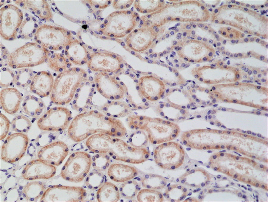 Anti-p120 Catenin Rabbit Monoclonal Antibody, Clone RM353