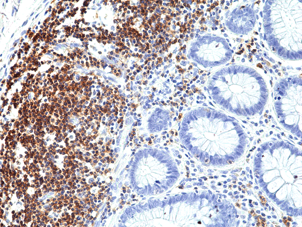 Anti-CD5 Rabbit Monoclonal Antibody, Clone RM354 (N-Terminus)