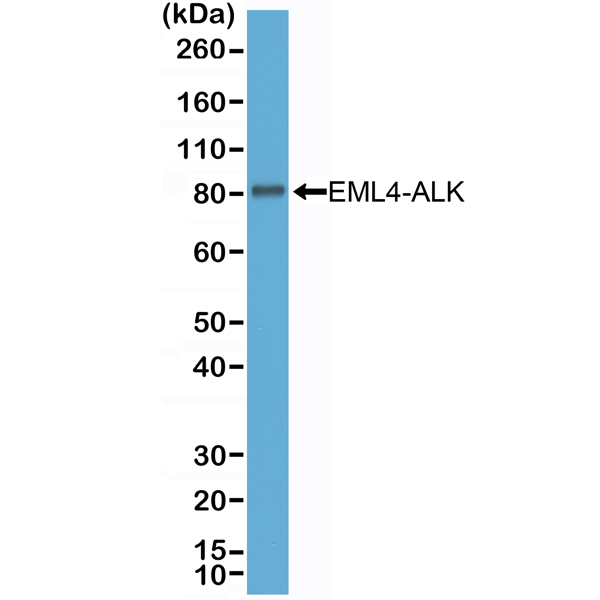 Anti-ALK Rabbit Monoclonal Antibody, Clone RM361