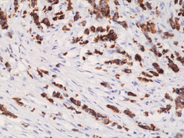 Anti-CK-19 (Cytokeratin-19) Rabbit Monoclonal Antibody, Clone RM364