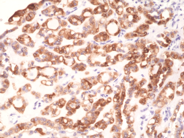 Anti-TPO (Thyroid peroxidase) Rabbit Monoclonal Antibody, Clone RM368