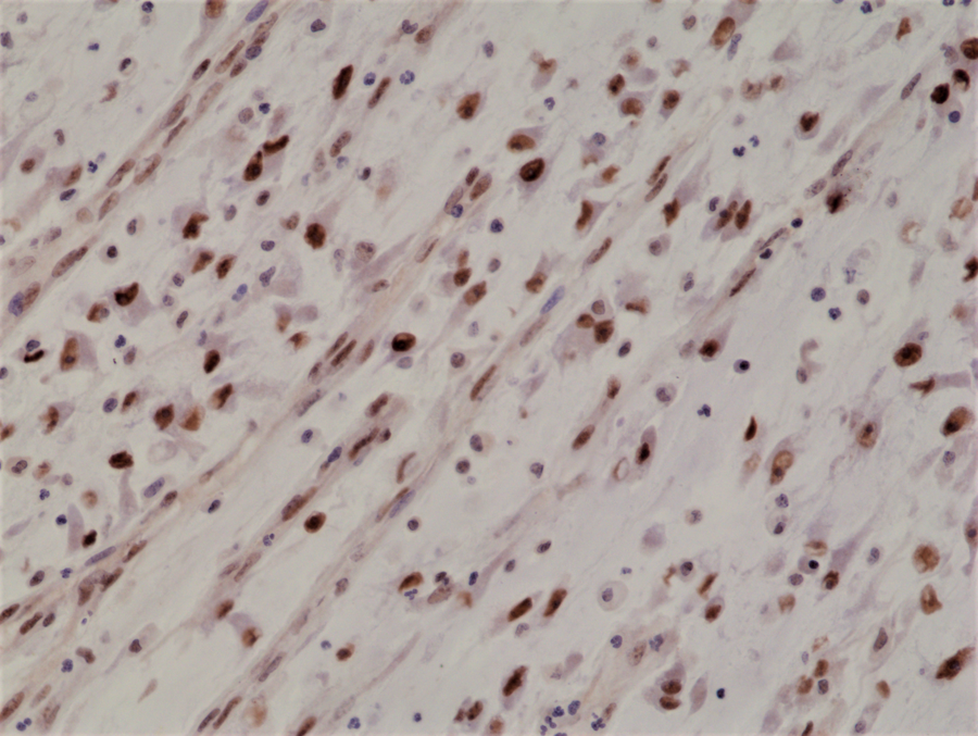 Anti-MyoD1 Rabbit Monoclonal Antibody, Clone RM369