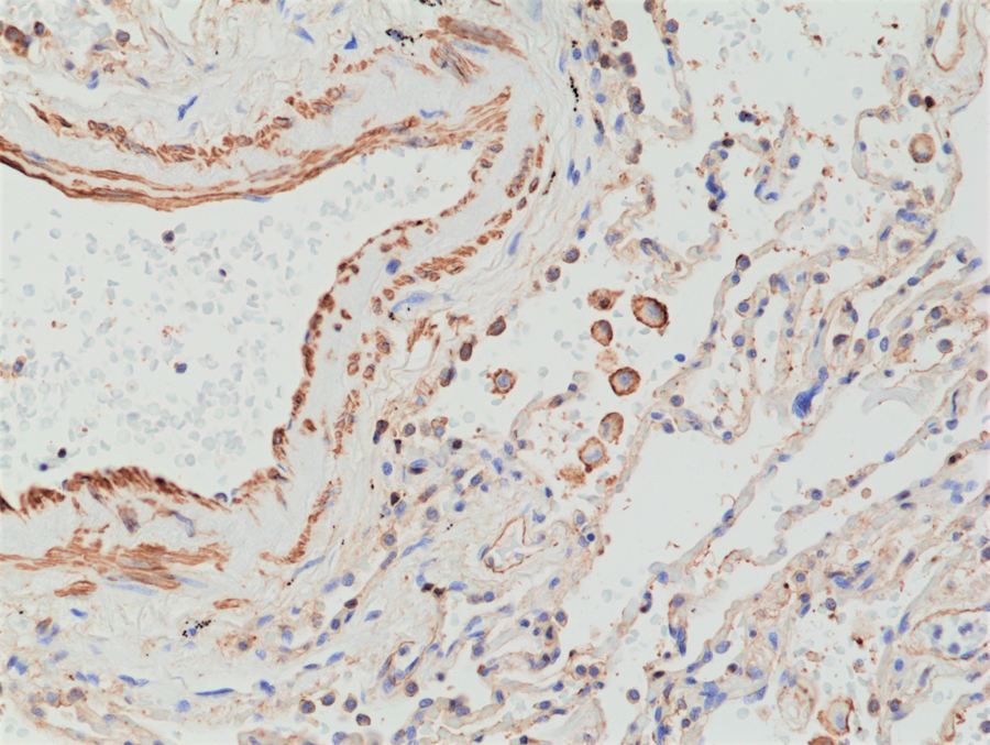 Anti-Matrix metalloproteinase-12 (MMP-12) Rabbit Monoclonal Antibody, Clone RM381