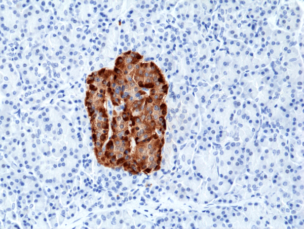 Anti-Chromogranin A Rabbit Monoclonal Antibody, Clone RM385