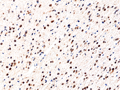 Anti-IDH1(R132H) Rabbit Monoclonal Antibody, Clone RM390