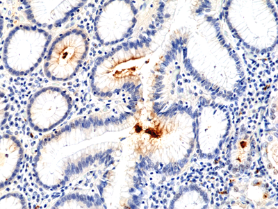 Anti-H.Pylori Rabbit Monoclonal Antibody, Clone RM400