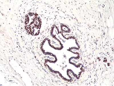 Anti-Foxp1 Rabbit Monoclonal Antibody, Clone RM402