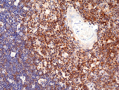 Anti-CD28 Rabbit Monoclonal Antibody, Clone RM404