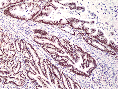 Anti-MSH3  Rabbit Monoclonal Antibody, Clone RM405
