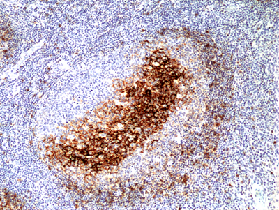 Anti-CD23(FcER-II) Rabbit Monoclonal Antibody, Clone RM406