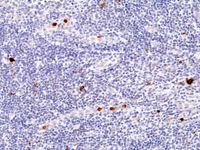 Anti-Myeloperoxidase (MPO) Rabbit Monoclonal Antibody, Clone RM407