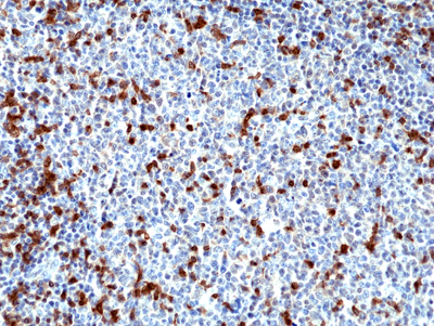 Anti-ZAP70 Rabbit Monoclonal Antibody, Clone RM408