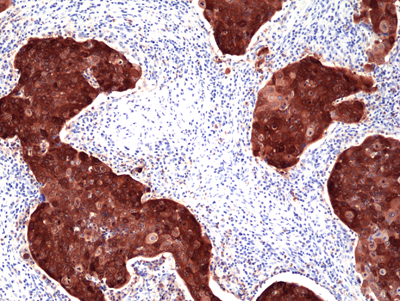 Anti-p16 INK4a Rabbit Monoclonal Antibody, Clone RM409