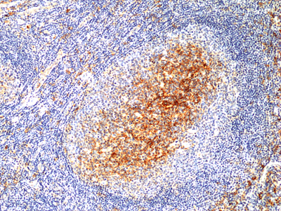 Anti-CD14  Rabbit Monoclonal Antibody, Clone RM415