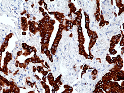 Anti-CK-7 (Cytokeratin-7) Rabbit Monoclonal Antibody, Clone RM416