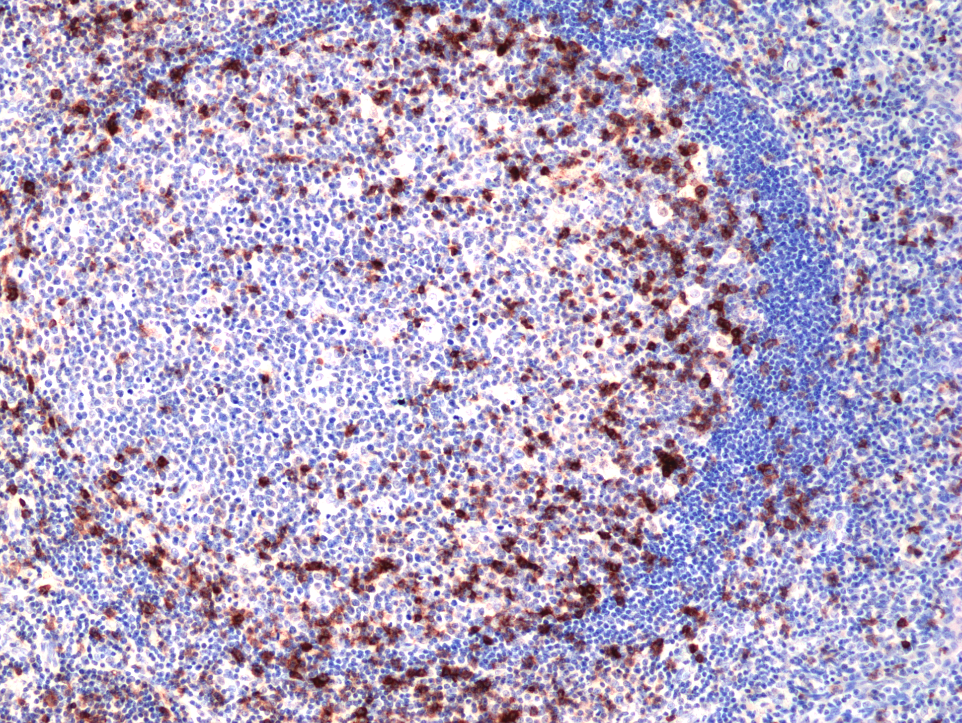 Anti-CD278 Rabbit Monoclonal Antibody, Clone RM417