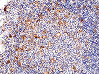 Anti-CD25 (IL2R&alpha;) Rabbit Monoclonal Antibody, Clone RM418