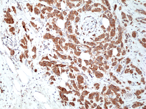 Anti-Musashi 2 (MSl2) Rabbit Monoclonal Antibody, Clone RM422