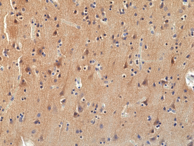 Anti-TRK(pan) Rabbit Monoclonal Antibody, Clone RM423