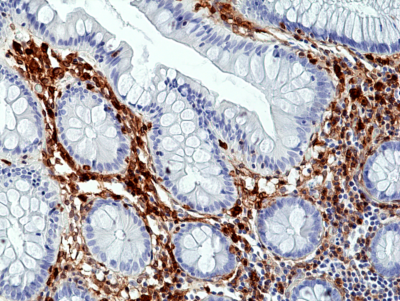 Anti-Annexin A1 Rabbit Monoclonal Antibody, Clone RM424