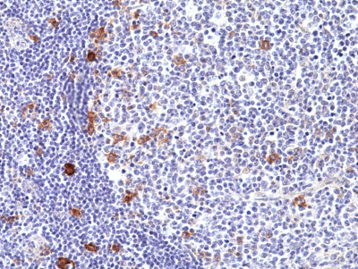 Anti-CD30 Rabbit Monoclonal Antibody, Clone RM425