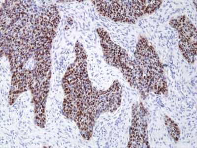 Anti Sox2 Rabbit Monoclonal Antibody, Clone RM427