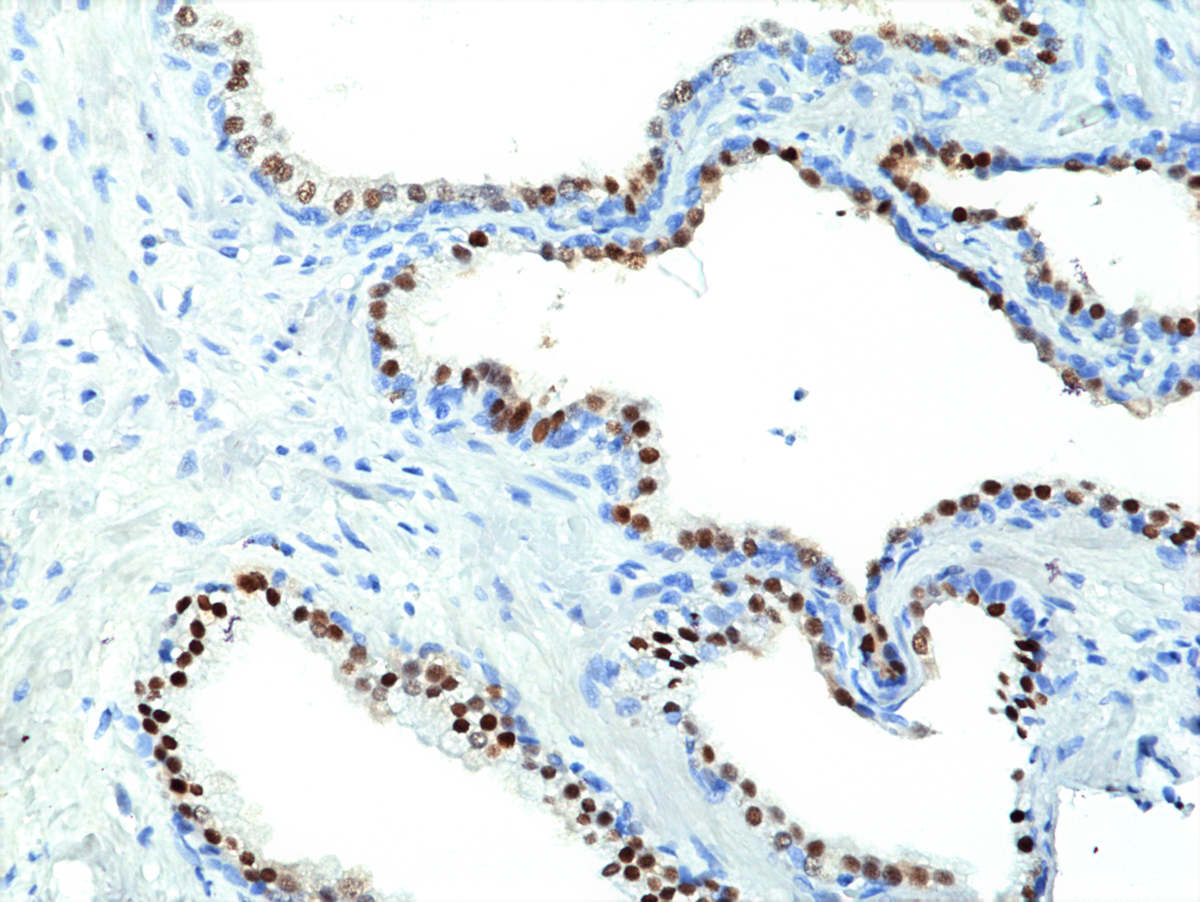 Anti-Nkx3.1 Rabbit Monoclonal Antibody, Clone RM430
