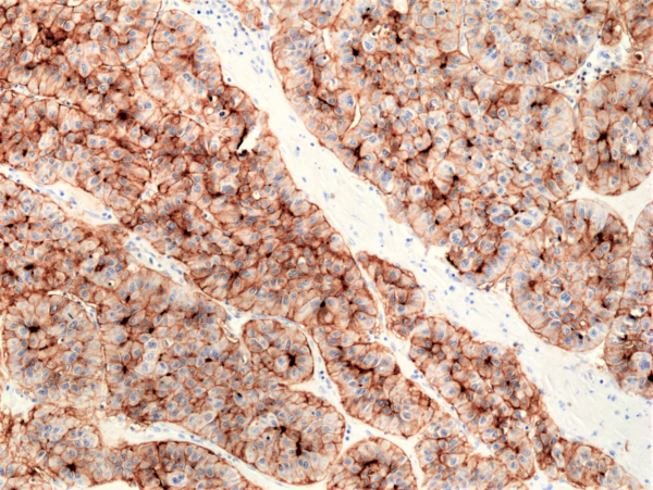 Anti-CD73 Rabbit Monoclonal Antibody, Clone RM431
